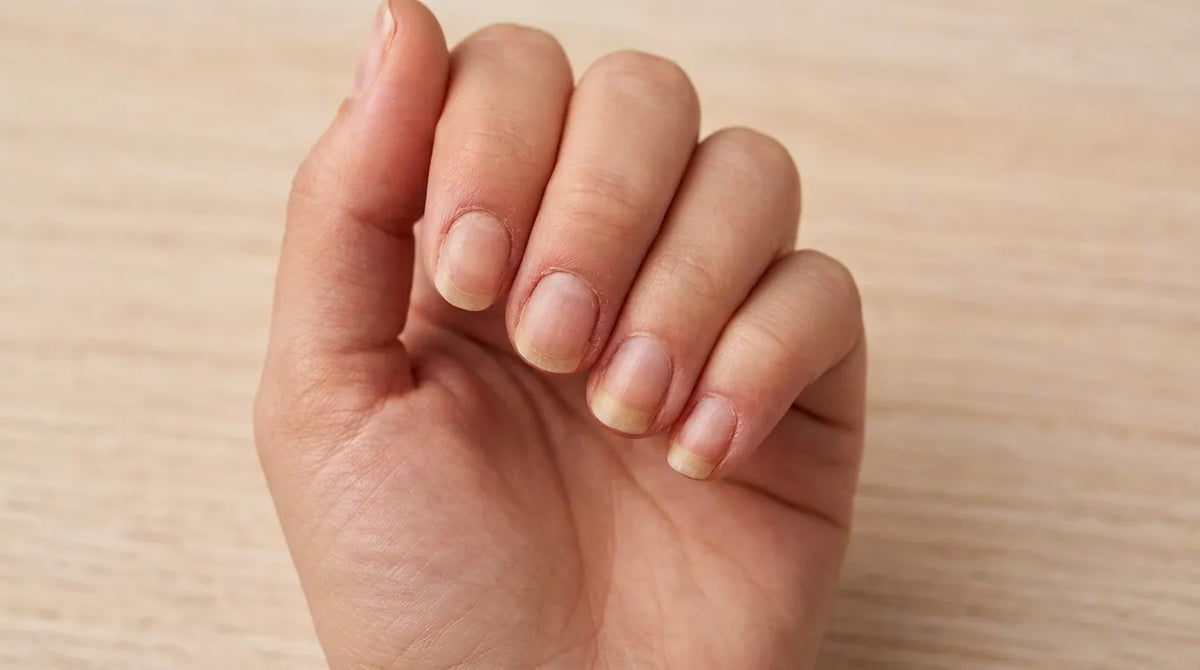 Natural, bare nails with clean cuticles, ready for a manicure.